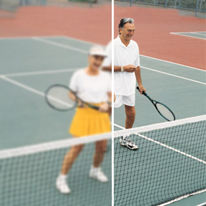 Tennis Cataract View